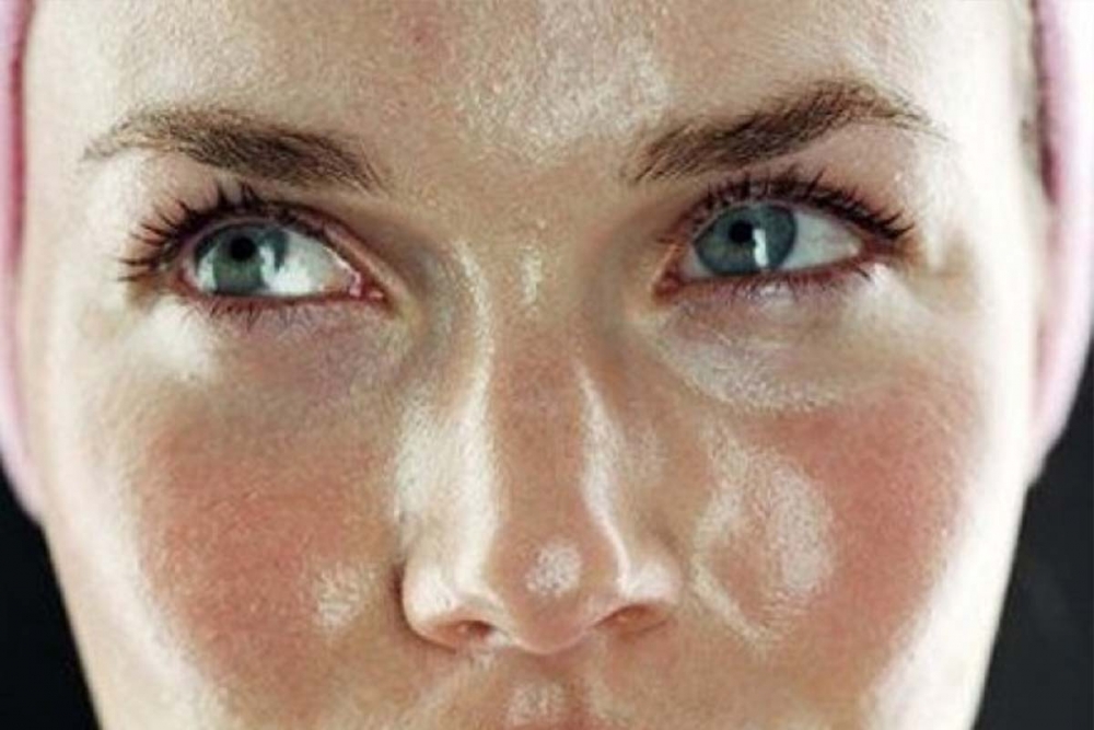 Как избавиться от жирной кожи навсегда