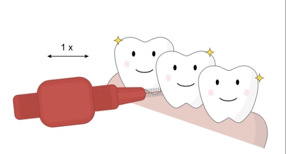 Межзубные щетки. Гигиена полости рта