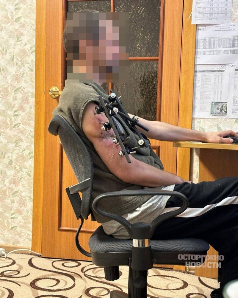 🚨 Раненные контрактники: тревожные истории из зоны СВО