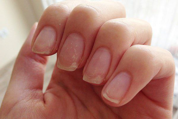 Маска для укрепления ломких ногтей💅