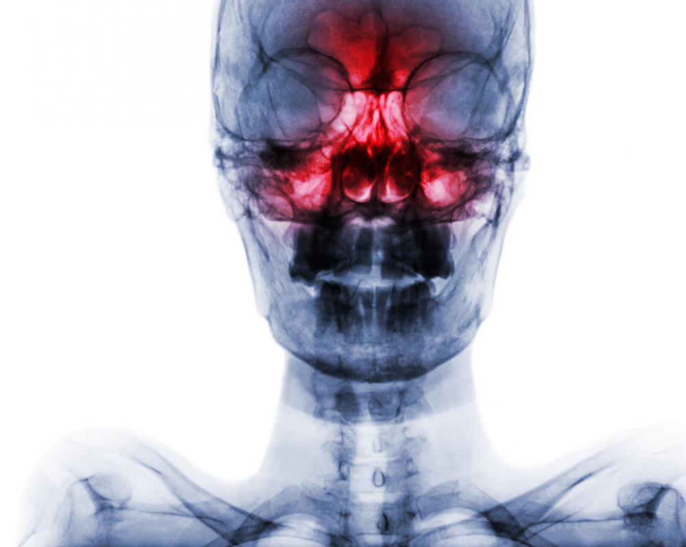 В чем смысл синуситов?