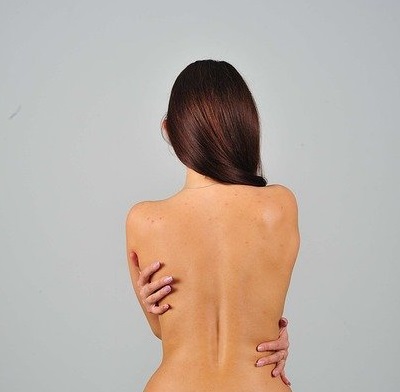 Акне на спине. Как избавиться?