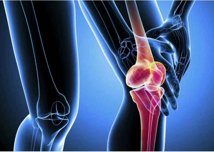 Чем опасен артрит?