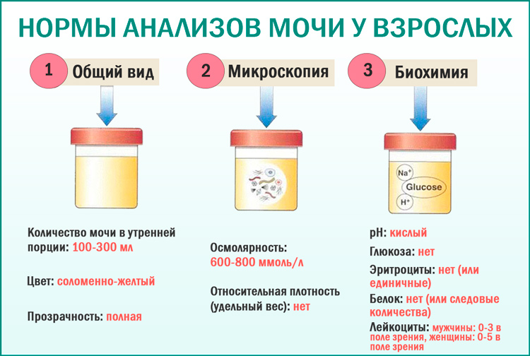 Где хранить анализ мочи до сдачи. Подготовка к сдаче общего анализа мочи памятка. Правильный сбор мочи на общий анализ. Правила сбора мочи для клинического анализа. Подготовка пациента к сбору мочи на общий анализ мочи.