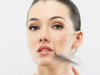  Как уменьшить пигментацию кожи? Забота, защита и советы для здоровья