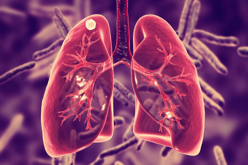 Первичный туберкулез обычно возникает, в каких отделах легких: