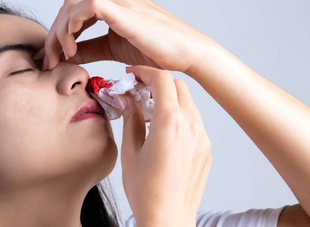 Что НЕ нужно делать при носовом кровотечении?