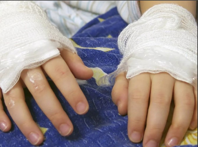 Как одеваться во время морозов, чтобы избежать обморожений?