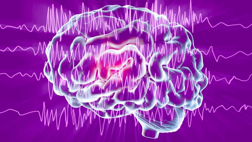 Инструментальный алгоритм обследования при эпилепсии содержит…