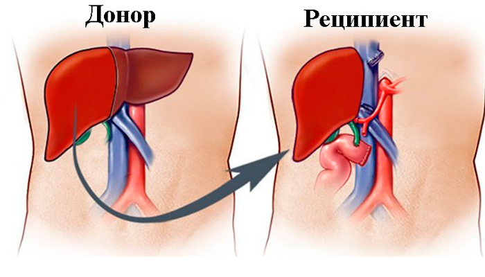 Пересадка печени возможна, так как печень обладает способностью к: