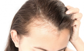 Корень лопуха для волос и его удивительная польза